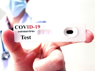 CÂMARA DISPONIBILIZA R$ 54 MIL PARA TESTES RÁPIDOS